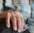 Дело об избиении 78-летней бабушки в пансионате заинтересовало главу СКР Бастрыкина - Вести-Москва