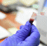 Pharmaceutics: В России научились определять рак мозга на ранней стадии по анализу крови - РТВ-Подмосковье