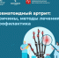 Ревматоидный артрит - ГБУЗ МО МОНИКИ
